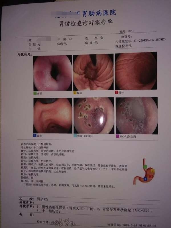 胃肠病在线咨询